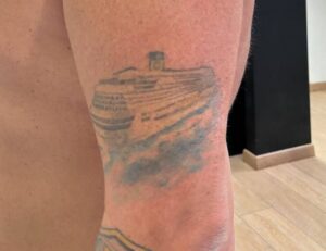 Foto prima della copertura di un vecchio tatuaggio nave da crociera Umbria Acca Elena Ink